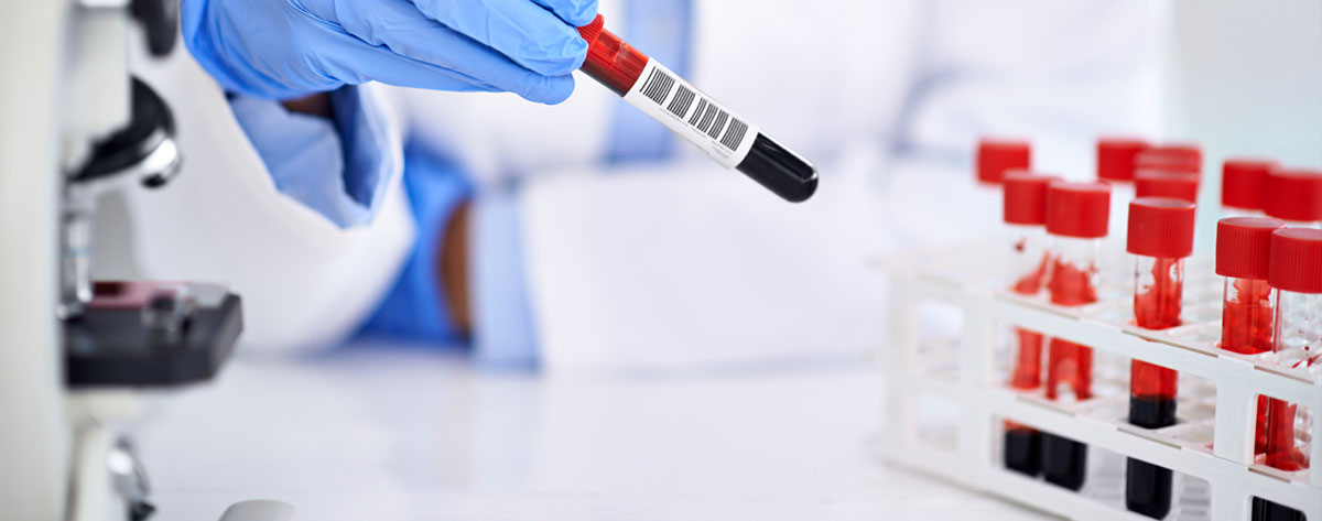 Laboratorio clínico la 100